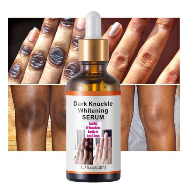 Dark knuckles whitening serum